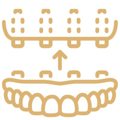 full arch graphic