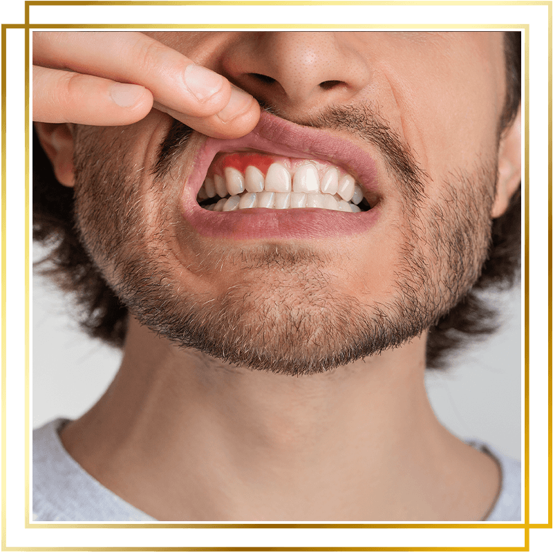 Gum disease