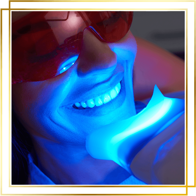 Teeth Whitening