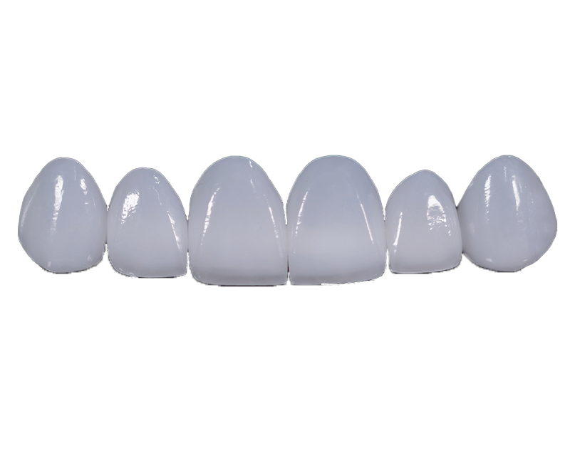 veneers